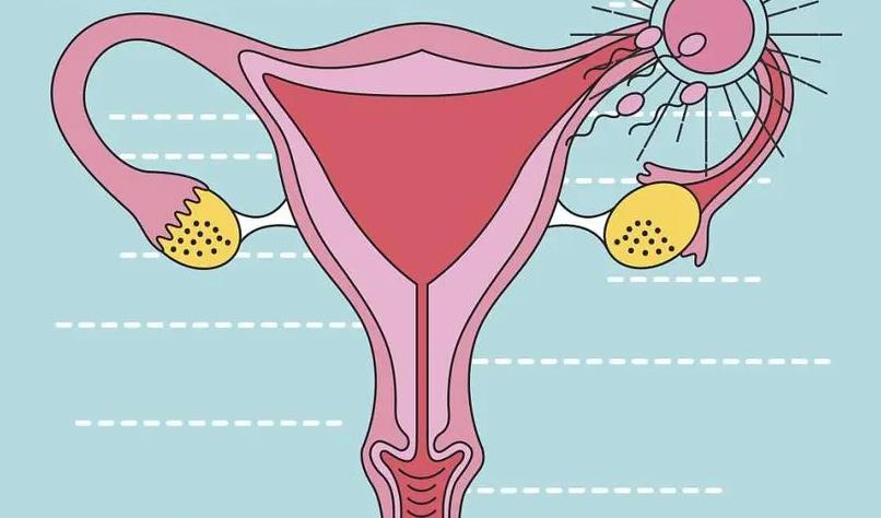 卵巢早衰多囊/子宫问题